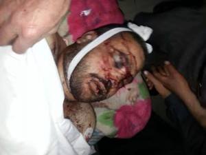 Photo of URGENT- Syrian Army killed fierce terrorist Issa Meflah along eith other 19 terrorists in Dar’a