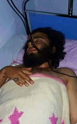 Photo of BREAKING- Saudi Terrorist commander, Abo Al- Kalka, wounded by Syrian Army during attack in Jisr Al-Shougur died in a hospital in Turkey’s Gaziantep.
