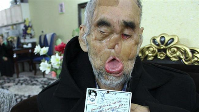 Photo of Heroic Iranian veteran departs heavenwards