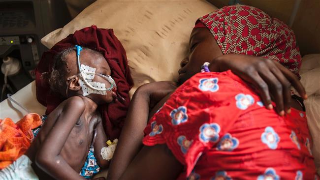 Photo of UN says donations needed to avert death of 75,000 starving Nigerian kids
