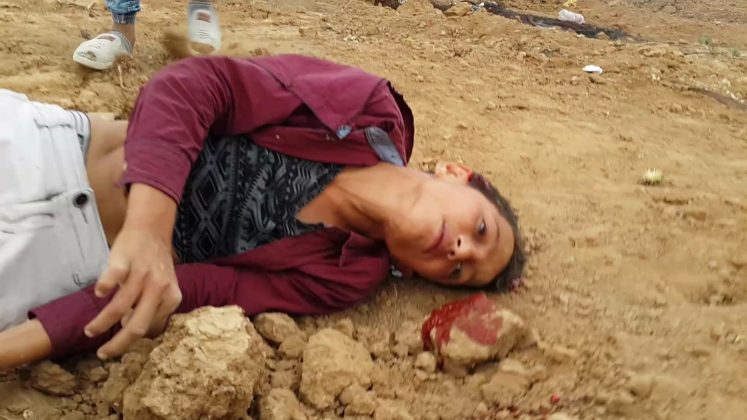 Photo of MASSACRE IN THE EYES OF THE WORLD(+13): Rabid zionist butcher israhell shoot 15 year old child in the head, brings Gaza death toll to 39