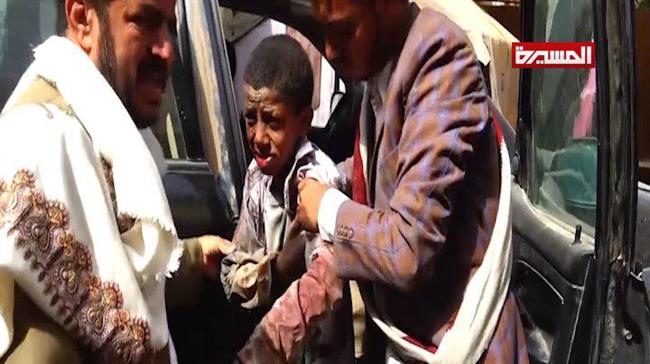 Photo of ZIONIST SAUDI MASSACRE: Saudi jets attack bus carrying children, leave 43 civilians dead